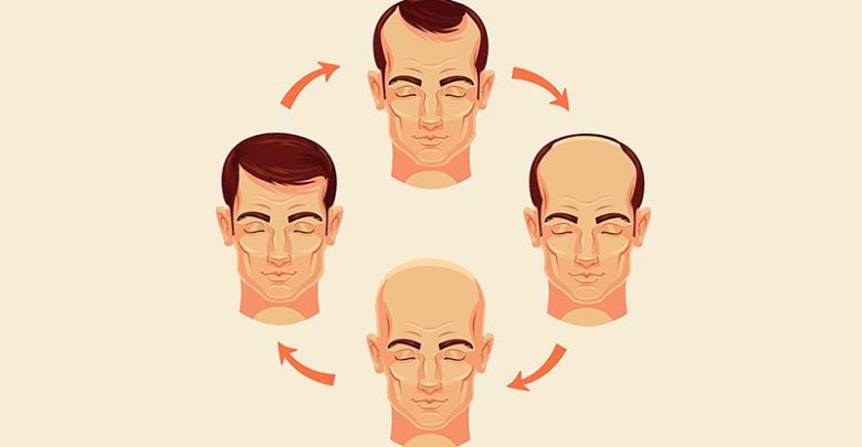 Hair Loss